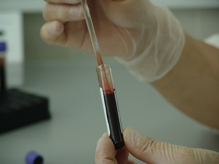 person holding test tube with blood