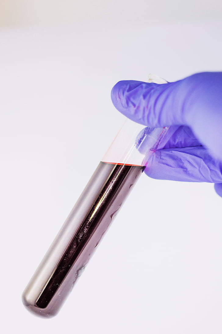 person in purple gloves holding test tube with liquid