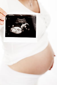 person holding ultrasound paper