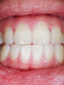closeup photo of person's teeth