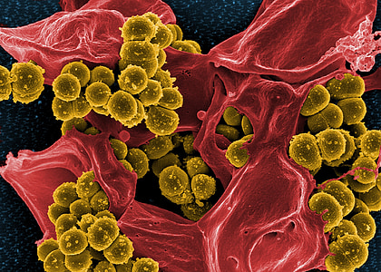 microscopic photograph of bacteria