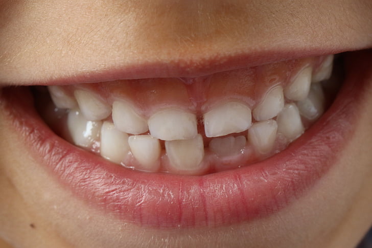 person white teeth