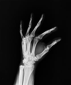 hand X-ray